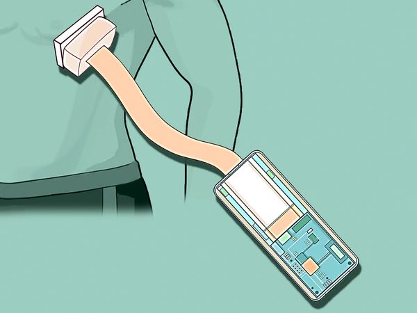 超声贴片或成未来心脏起搏器:声遗传学基因疗法成关键